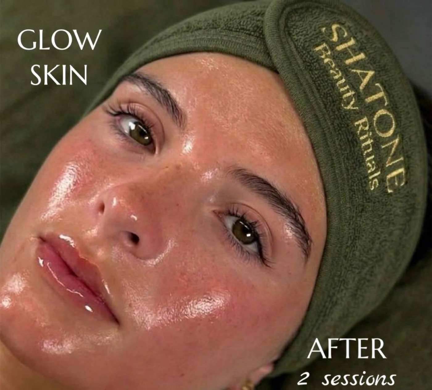 Glow — before/after result