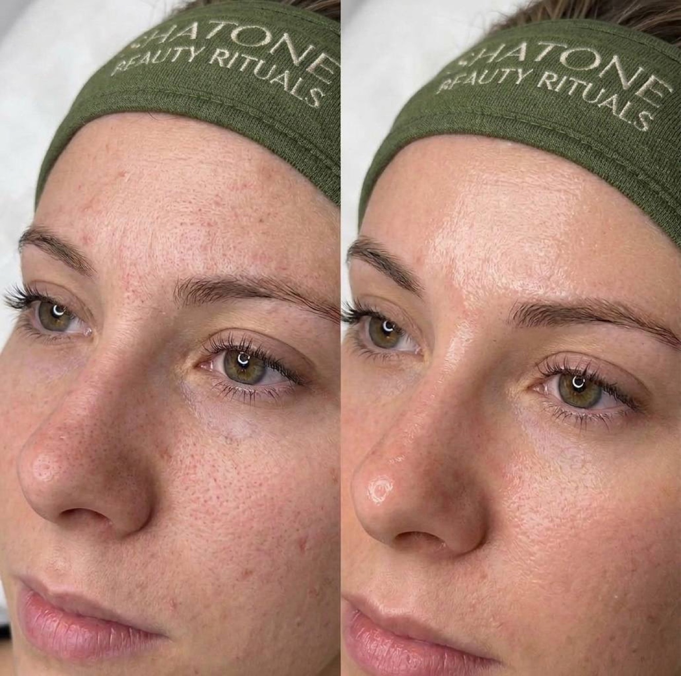 Purity — before/after result