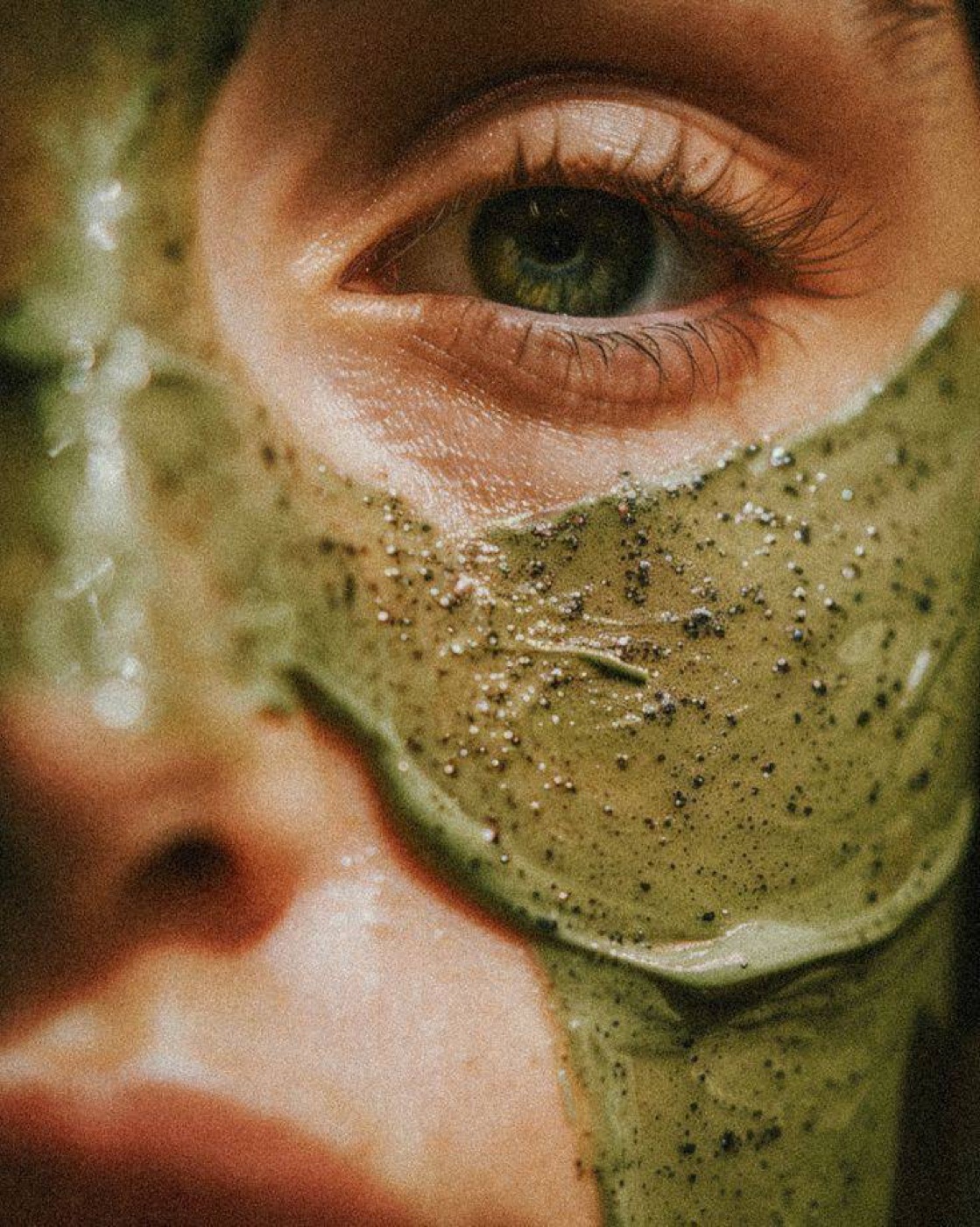Acne Control