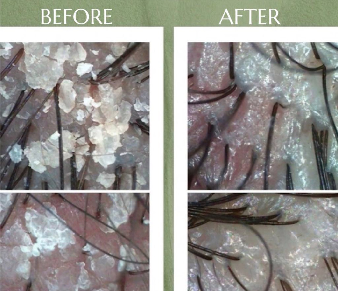 Scalp Detox & Body — before/after result